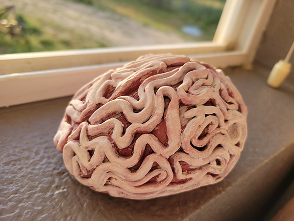 Anatomical Brain